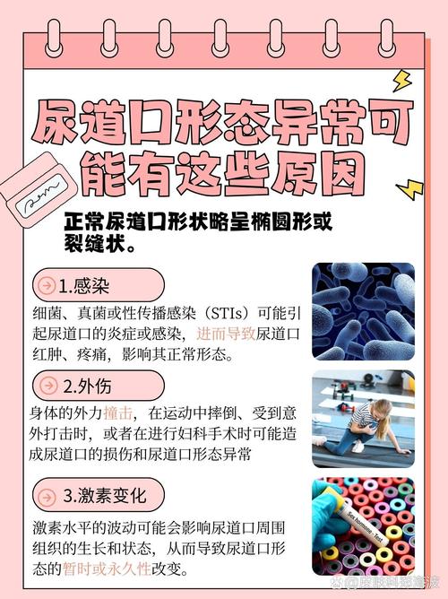 国产干逼免费的相关介绍